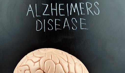 Alzheimer's Disease