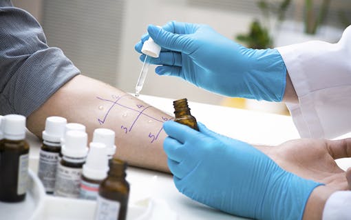 Allergy test