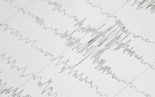 proper thc dosage impacts the effects marijuana has on the brain