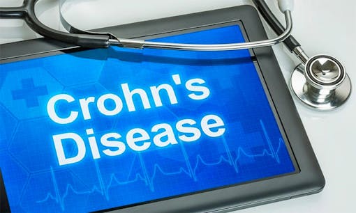 crohn's disease