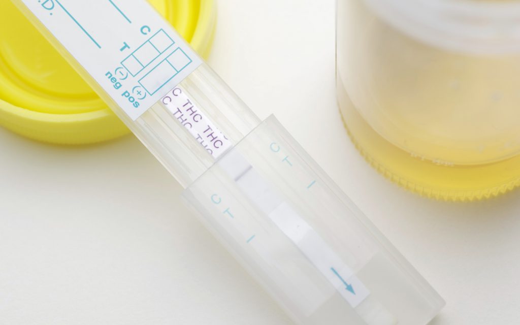 Urinalysis marijuana, drug test, positive drug test