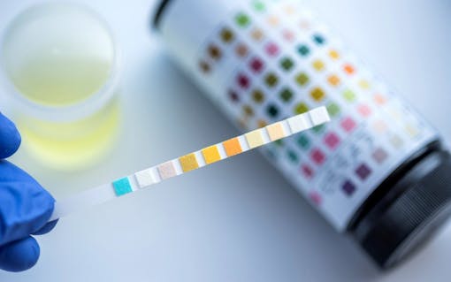 urinalysis marijuana, drug test, positive drug test