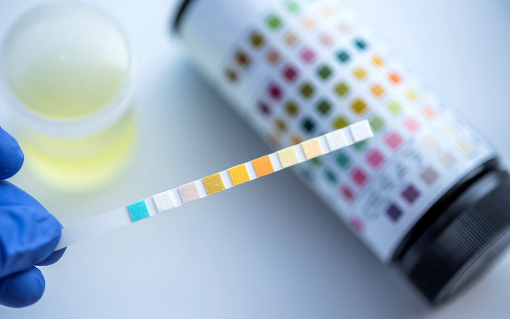 Urinalysis marijuana, drug test, positive drug test