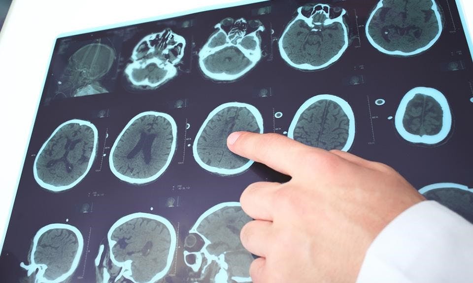 Virginia Sees the Alarming Effects of Epilepsy and Georgia Won’t Take “No” For an Answer: The Leafly Cannabis Legalization Update image