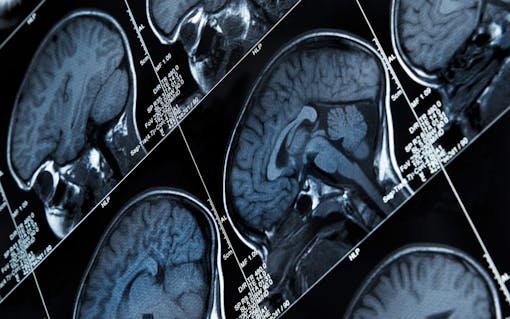 MRI Brain Scan results of heads and skulls