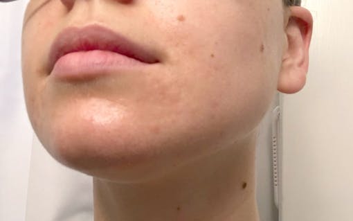 Beautiful skin after applying cannabis topicals for a month.