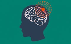 cannabis use for headaches and migraines, marijuana and migraines, pain relief with cannabis