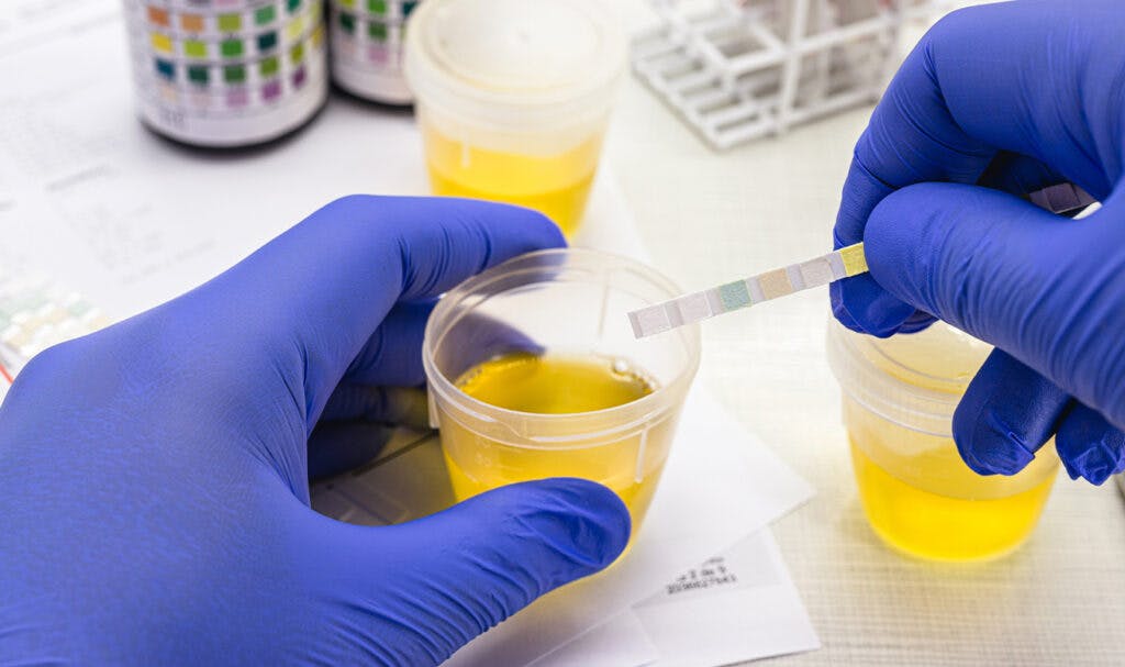 How to pass a drug test for weedthe ultimate guide Leafly