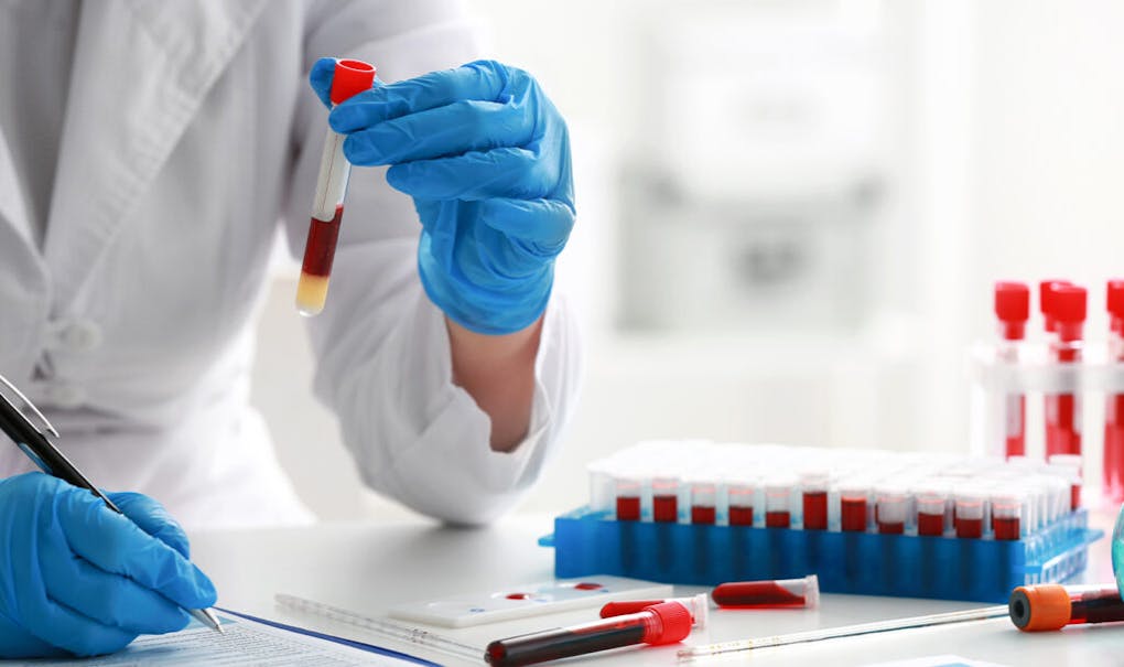 How to pass a drug test for weedthe ultimate guide Leafly