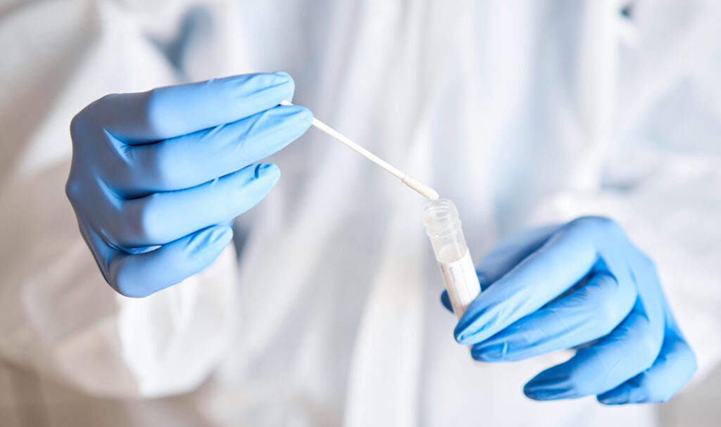 How to pass a drug test for weedthe ultimate guide Leafly