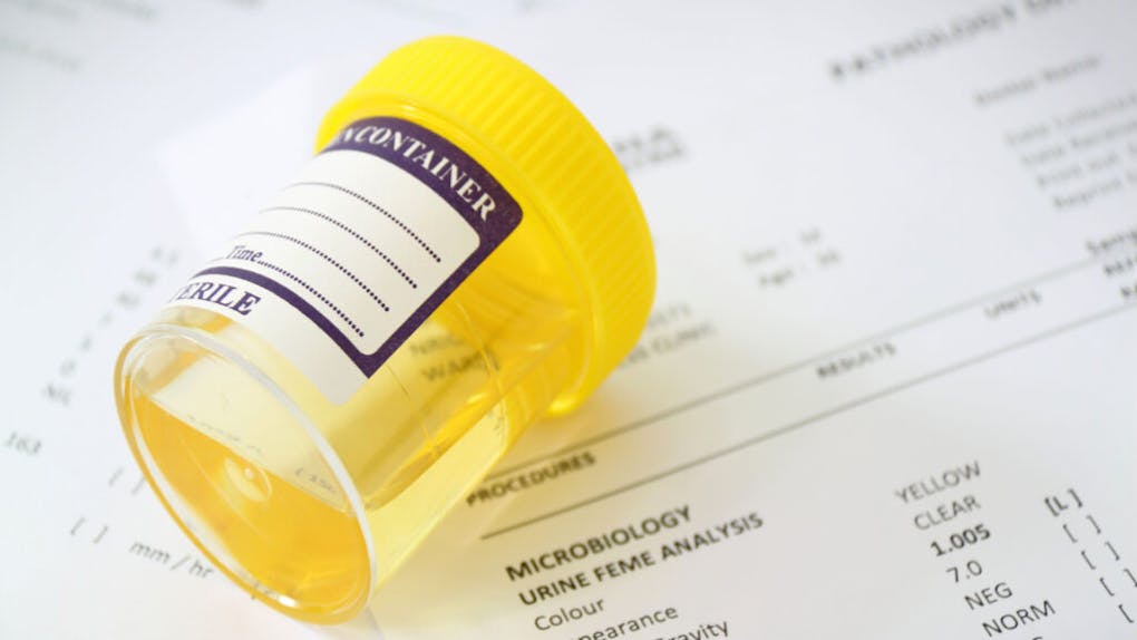 Will delta8, delta10, or HHC make you fail a drug test? Leafly