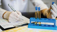 person wearing latex gloves holding a test tube in one hand and writing on a clipboard form with the other. only their hands and torso are visible